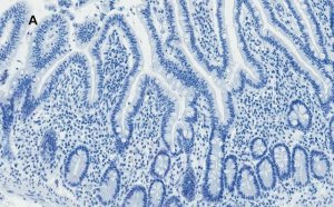 Anti-AMPK alpha Antibody, clone 2D22, ZooMAb� Rabbit Monoclonal 