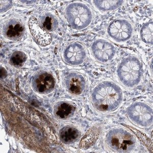 Anti-AMTN antibody produced in rabbit 