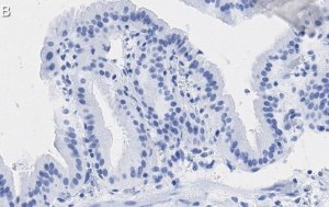 Anti-Angiopoietin-1 Antibody, clone 2F9 ZooMAb� Rabbit Monoclonal 