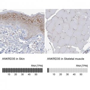 Anti-ANKRD35 antibody produced in rabbit 