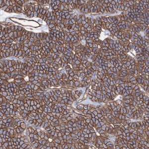 Anti-ANKRD37 antibody produced in rabbit 