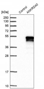 Anti-ANKRD40 antibody produced in rabbit 