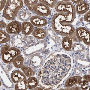 Anti-ANKRD40 antibody produced in rabbit 