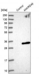 Anti-ANKRD46 antibody produced in rabbit HPA013758-100UL