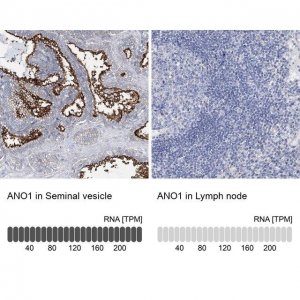 Anti-ANO1 antibody produced in rabbit 