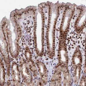 Anti-AP5Z1 antibody produced in rabbit 