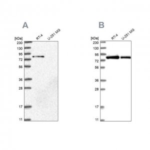 Anti-APEH antibody produced in rabbit 