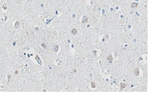 Anti-APP Antibody, clone 1F22 ZooMAb� Rabbit Monoclonal 