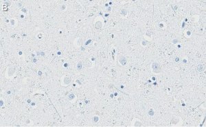 Anti-APP Antibody, clone 1F22 ZooMAb� Rabbit Monoclonal 