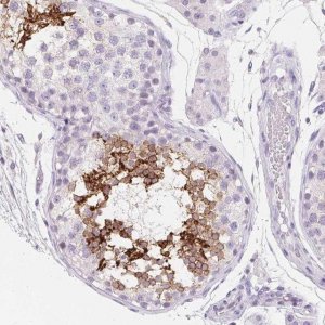Anti-AQP5 antibody produced in rabbit 
