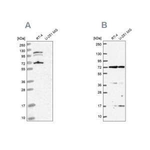 Anti-ARAF antibody produced in rabbit HPA046188-100UL