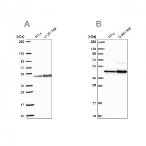 Anti-ARFGAP1 antibody produced in rabbit 