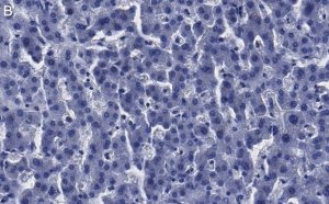 Anti-Arginase-1 Antibody, clone 3B17 ZooMAb� Rabbit Monoclonal 