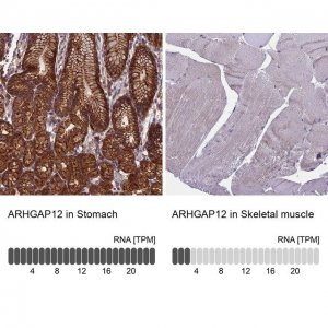 Anti-ARHGAP12 antibody produced in rabbit 