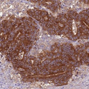 Anti-ARHGAP12 antibody produced in rabbit 