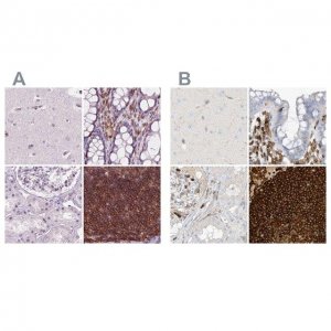 Anti-ARHGAP25 antibody produced in rabbit 