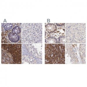 Anti-ARHGAP4 antibody produced in rabbit 