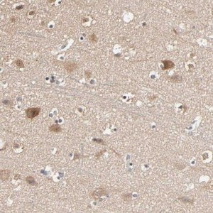 Anti-ARHGEF7 antibody produced in rabbit 