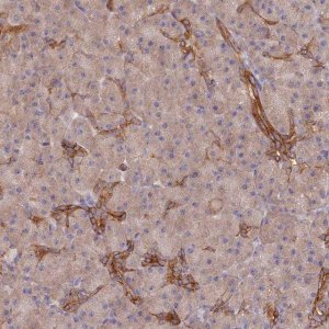 Anti-ARRDC1 antibody produced in rabbit HPA044345-100UL