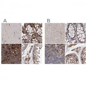 Anti-ASCC3 antibody produced in rabbit 