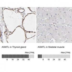 Anti-ASMTL antibody produced in rabbit 
