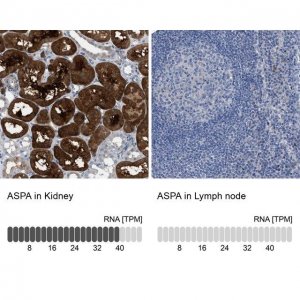 Anti-ASPA antibody produced in rabbit HPA022142-100UL