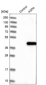 Anti-ASPA antibody produced in rabbit HPA022142-100UL