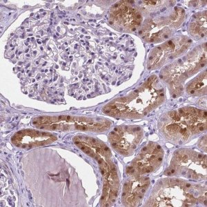 Anti-ASPG antibody produced in rabbit HPA069761-100UL