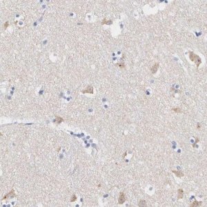 Anti-ASPHD2 antibody produced in rabbit 