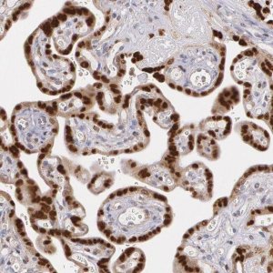 Anti-ATF3 antibody produced in rabbit 