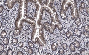 Anti-ATM Antibody, clone 4N19, ZooMAb� Rabbit Monoclonal 