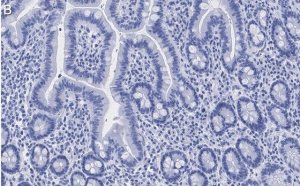 Anti-ATM Antibody, clone 4N19, ZooMAb� Rabbit Monoclonal 