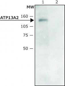 Anti-ATP13A2 (C-terminal region) antibody produced in rabbit 