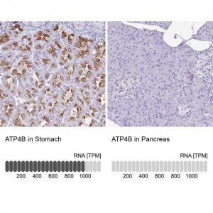 Anti-ATP4B antibody produced in rabbit 