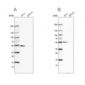 Anti-ATP5A1 antibody produced in rabbit HPA040622-100UL