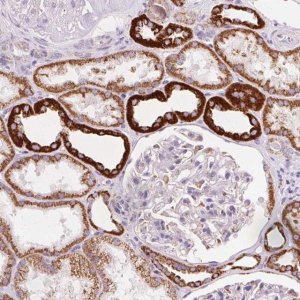 Anti-ATP5O antibody produced in rabbit HPA041394-100UL