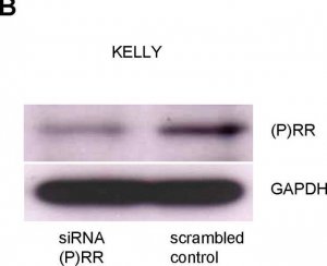 Anti-ATP6AP2 antibody produced in rabbit 