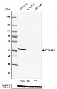 Anti-ATP6AP2 antibody produced in rabbit 