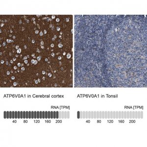 Anti-ATP6V0A1 antibody produced in rabbit 