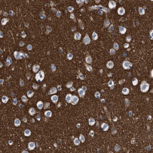 Anti-ATP6V0A1 antibody produced in rabbit 
