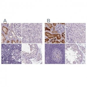 Anti-ATP6V1D antibody produced in rabbit 