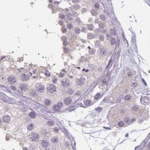 Anti-ATP6V1D antibody produced in rabbit 