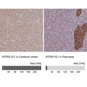 Anti-ATP6V1E1 antibody produced in rabbit HPA029196-100UL