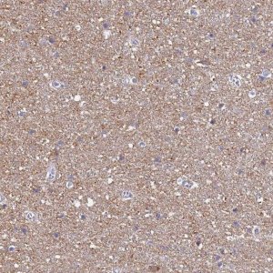 Anti-ATP6V1E1 antibody produced in rabbit HPA029196-100UL