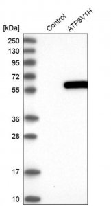 Anti-ATP6V1H antibody produced in rabbit 