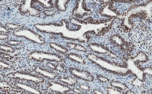 Anti-ATRX Antibody, clone 2A12, ZooMAb� Rabbit Monoclonal 