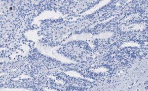 Anti-ATRX Antibody, clone 2A12, ZooMAb� Rabbit Monoclonal 