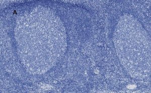Anti-Aurora B Antibody, clone 7C4, ZooMAb� Rabbit Monoclonal 