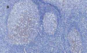 Anti-Aurora B Antibody, clone 7C4, ZooMAb� Rabbit Monoclonal 
