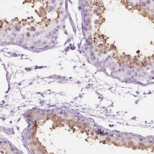 Anti-AXDND1 antibody produced in rabbit 